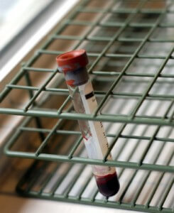 Blood Testing for a DUI